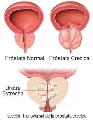 best prostate formula